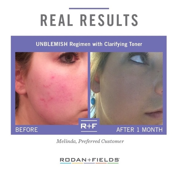 Rodan and Fields skincare! - Picture 2 of 2